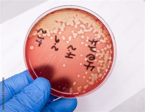 Beta Hemolytic Streptococcus Culture (.